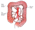 Colon, rectum and anus_14